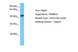 PRDM10 Rabbit anti-Human, Polyclonal, Novus Biologicals 0.1ml; Unconjugated:Antibodies,